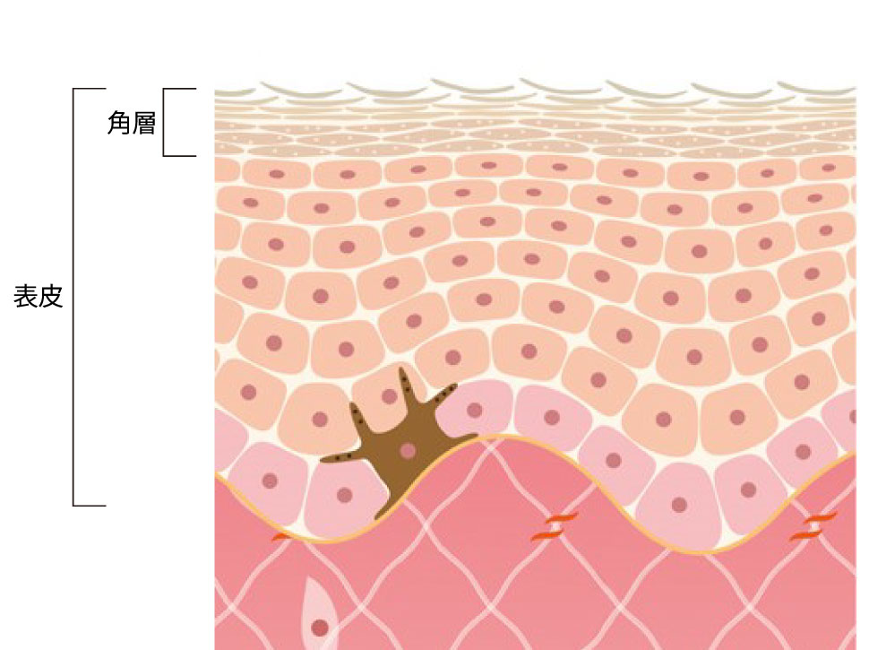 透明感のなさとは